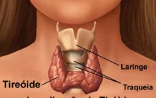 Tudo Sobre Hipotireoidismo