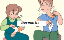 Dermatite De Contato – O Que É E Tratamento