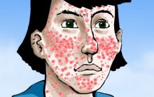 Anti Acne – Dicas