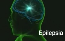 Epilepsia – Sintomas E Tratamento