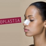 Rinoplastia