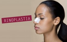 Rinoplastia Plástica – Para Que Serve, Benefícios, Qual o Preço, Fotos Antes e Depois, Vídeos