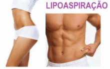 Lipoaspiração Feita a Laser – Como Fazer, Qual o Preço, Benefícios, Fotos Antes e Depois