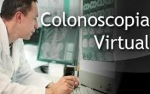 Colonoscopia – Como é Feito este Exame, Para que Serve e Qual Procedimento