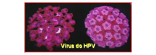 HPV – O Que é, Quais os Sintomas, Qual o Tratamento