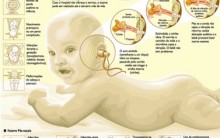 Teste Da Orelhinha De Bebês – Para Que Serve e Qual a Importância