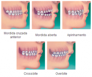 Ortodontia – Como é o Tratamento (1)