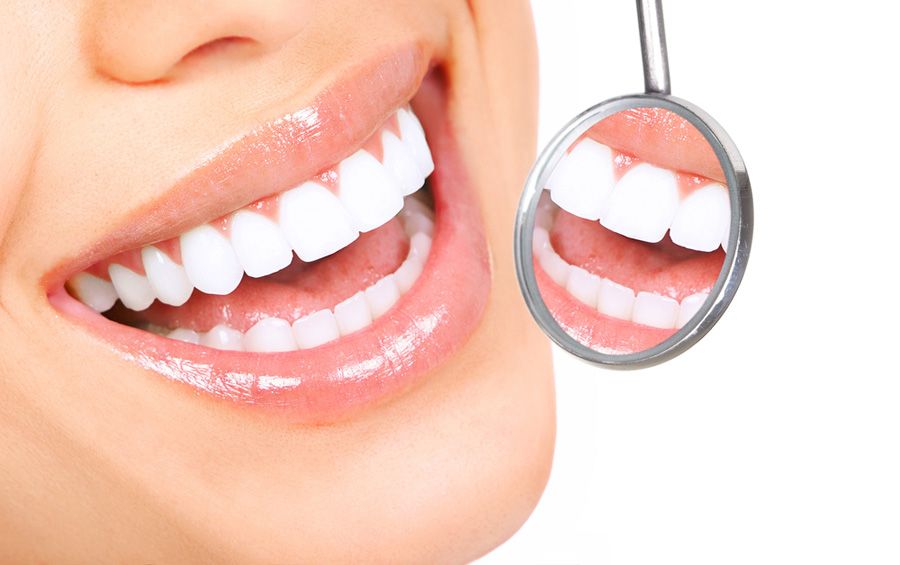 Lente de contato dental deixa o sorriso branco e correto